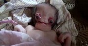 تولد نوزاد عجیب الخلقه و ترسناک در هند | نوزاد بدون گوش و شبیه موجودات فضایی / عکس