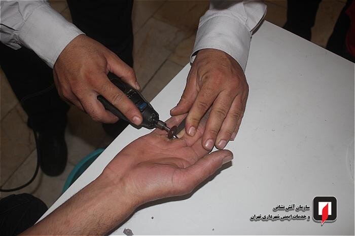گیرکردن انگشتر در دست جوان تهرانی دردسرساز شد! / عکس