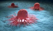 کشف روشی جدید برای جلوگیری از گسترش سلول‌های سرطانی