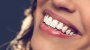 سفید کردن سریع دندان‌ها با چند روش کم‌هزینه