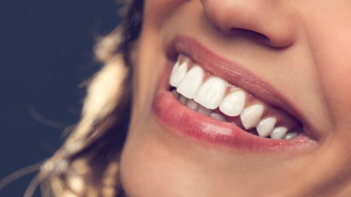 کمترین قیمت یونیت دندانپزشکی در ایران مربوط به کدام یونیت است ؟