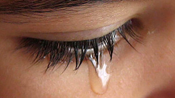 آشنایی با بیماری مرگباری که اشک خونین نشانه آن است
