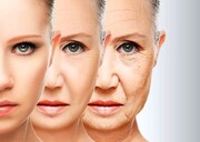 چرا زن‌ها زودتر از مردها پیر می‌شوند؟