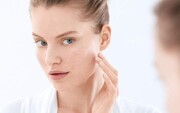 پیشگیری و درمان چروک‌های پوست صورت با چند ترفند ساده