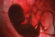 تصویب پنهانی طرح جنجالی حذف غربالگری جنین در مجلس