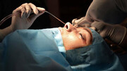 شیوه‌های مدرن پزشکی برای عمل جراحی بینی