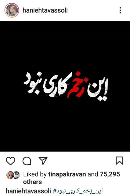 واکنش هانیه توسلی به سانسور «زخم کاری» / عکس