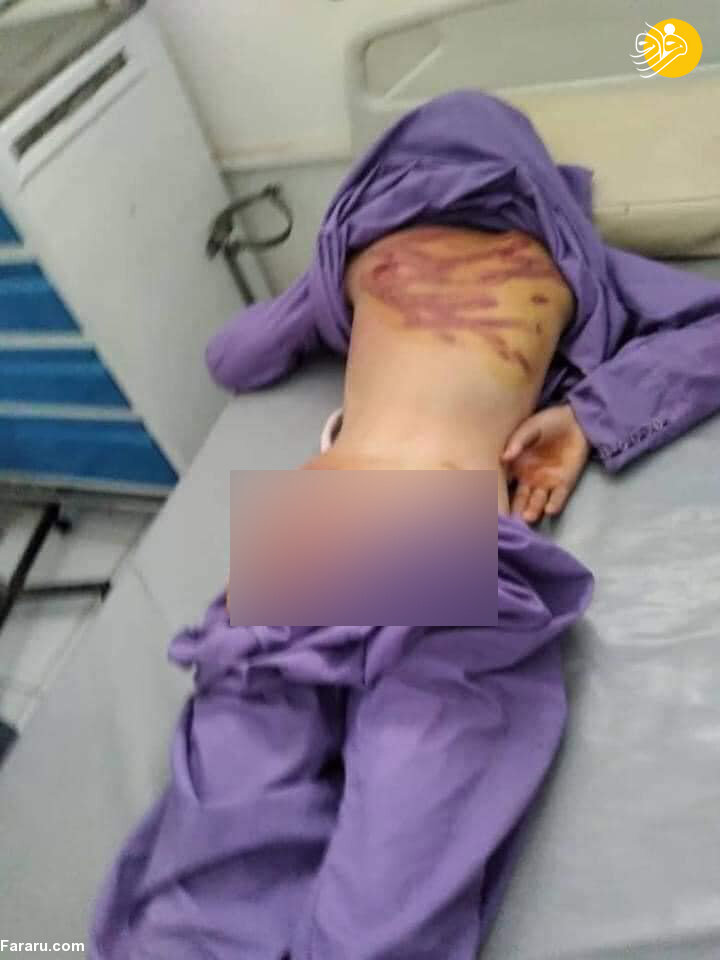 تصاویری دردناک از شلاق یک کودک توسط طالبان