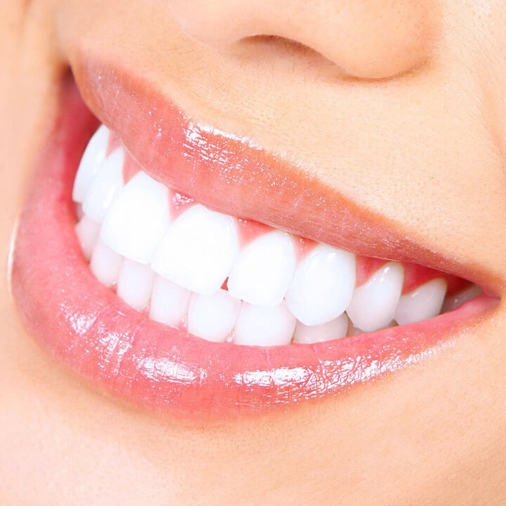 روش سفید کردن دندان با زردچوبه در ۵ دقیقه + آموزش