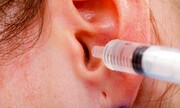 چگونه ترشحات چرکین گوش را درمان کنیم؟