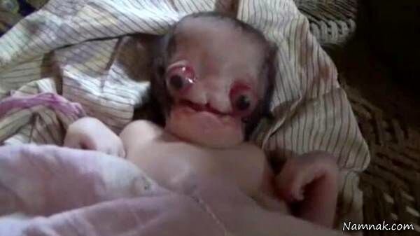ویدیو ترسناک از عجیب‌ترین نوزاد دنیا / فیلم