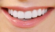 عوامل زردی دندان و روش‌هایی برای سفیدی آن‌ها