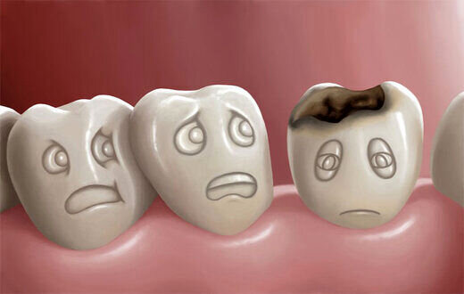این مواد غذایی دندانهای‌تان را از بین خواهد برد!