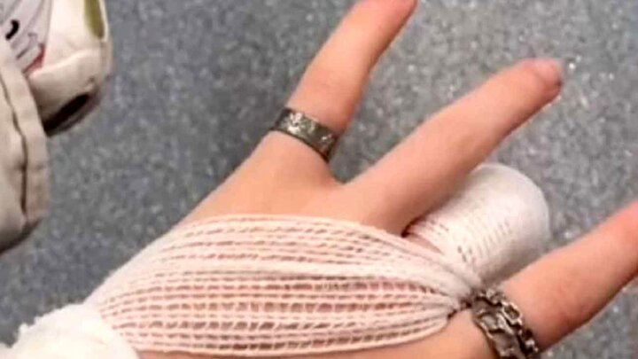ویدیو هولناک از قطع شدن انگشت ذست دختر جوان در کنسرت / عکس و فیلم