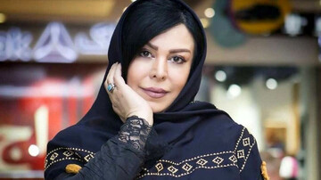 تغییر چهره شدید بازیگر زن مشهور ایرانی پس از انجام جراحی زیبایی / فیلم