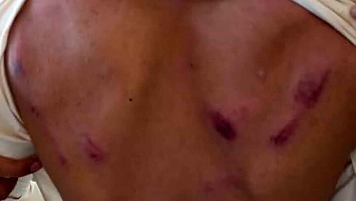 کتک زدن دانش آموز فنوجی به علت رعایت نکردن سکوت! / عکس