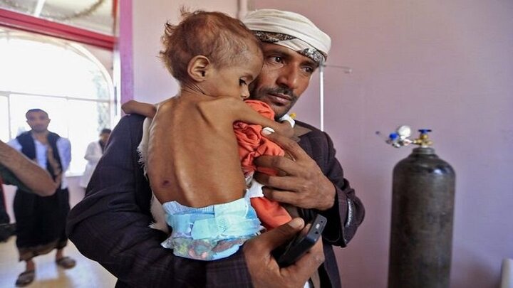 خطر تشدید بحران گرسنگی پیش روی میلیون‌ها خانواده یمنی 