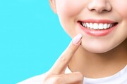 گران ترین و ارزان ترین راه های سفید کردن دندان