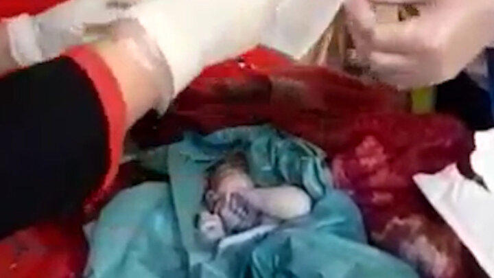 ویدیو هولناک از زایمان یک زن در سرویس بهداشتی در گیلان | مادر فرزند را در توالت رها کرد! / فیلم