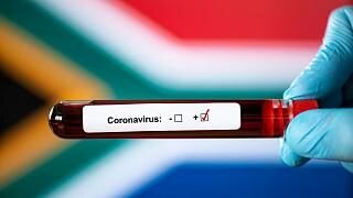 همه چیز درباره ویروس جدید کرونا در آفریقای جنوبی / این سویه چه تفاوتی با سویه‌های قبلی دارد؟