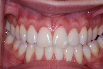 چگونه می‌توان از دهان و دندان به بهترین شکل مراقبت کرد؟