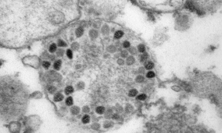 انتشار اولین تصویر از ویروس اُمیکرون