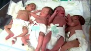 تصاویری از تولد چهارقلوها در گرگان / فیلم