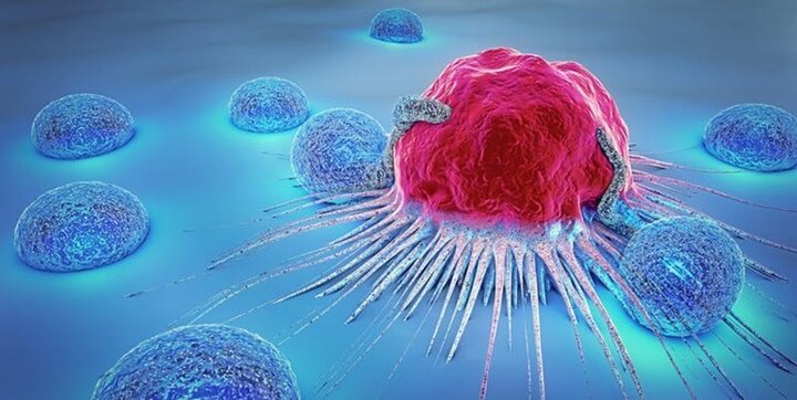 تشخیص سریع تومور سرطانی با کشف روشی خارق‌العاده توسط محققان ایرانی
