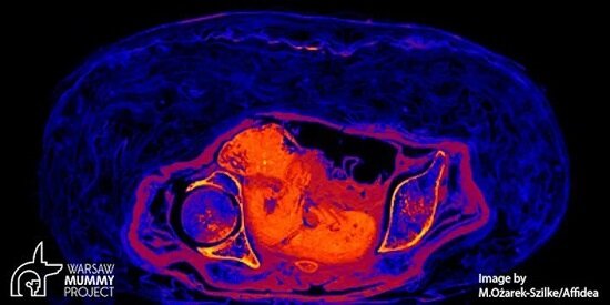 دانشمندان نخستین مومیایی باردار را شناسایی کردند