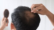 نحوه درمان ریزش مو پس از ابتلا به کرونا + چگونگی رویش مجدد / فیلم