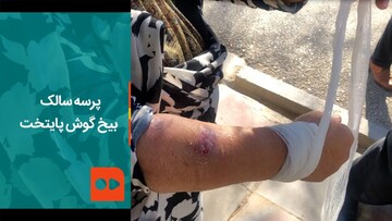 گزارشی تکان‌دهنده از افزایش شیوع یک بیماری انگلی در تهران / فیلم