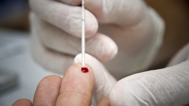 گونه جدید و خطرناک ویروس ایدز در هلند شناسایی شد!