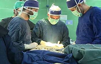 نخستین جراحی فک بر روی نوزاد ۲۳ روزه در ایران / فیلم