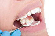 تاثیر کشیدن دندان و عدم ترمیم آن بر روی فرم صورت / فیلم