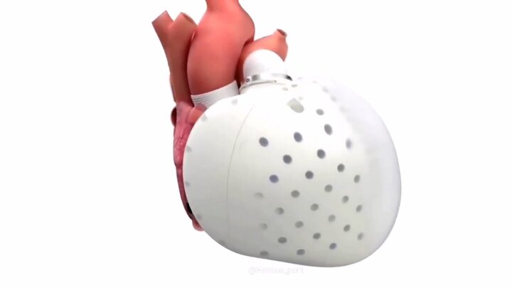 صدور مجوز فروش اولین قلب مصنوعی پس از سی سال / فیلم