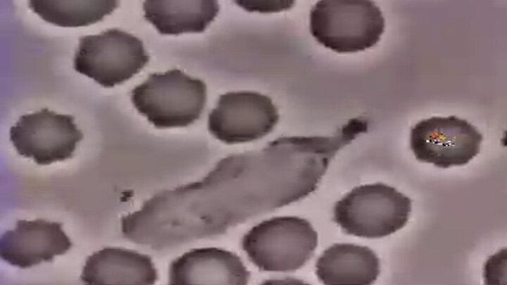 ویدیو جالب و دیده نشده از تعقیب و گریز یک گلبول سفید و باکتری 