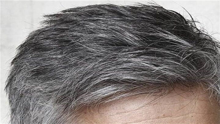 دلیل اصلی سفیدن شدن مو براثر افزایش سن چیست؟ / فیلم