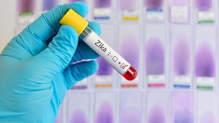 هشدار دانشمندان: مراقب ویروس زیکا باشید! / ویروس زیکا چیست و چه علائمی دارد؟