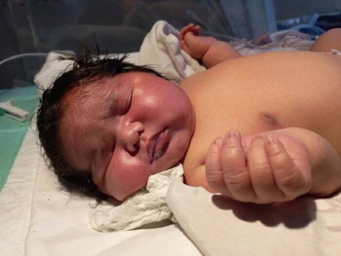 تولد نوزاد ۶.۵ کیلوگرمی در مشهد / عکس