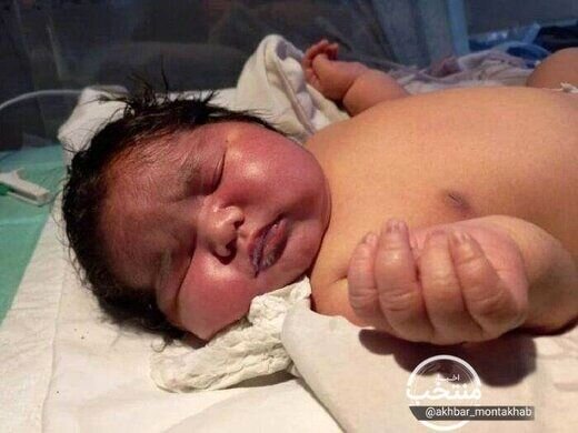 تولد سنگین‌وزن‌ترین نوزاد جهان در مشهد! / عکس