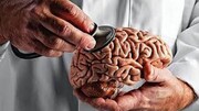مکان «اولین مغز» در بدن انسان کشف شد!