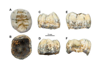 کشف دندان یک دختر باستانی