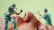 کاهش سن جراحی بینی در ایران / تقاضای مردان برای عمل زیبایی افزایش یافت