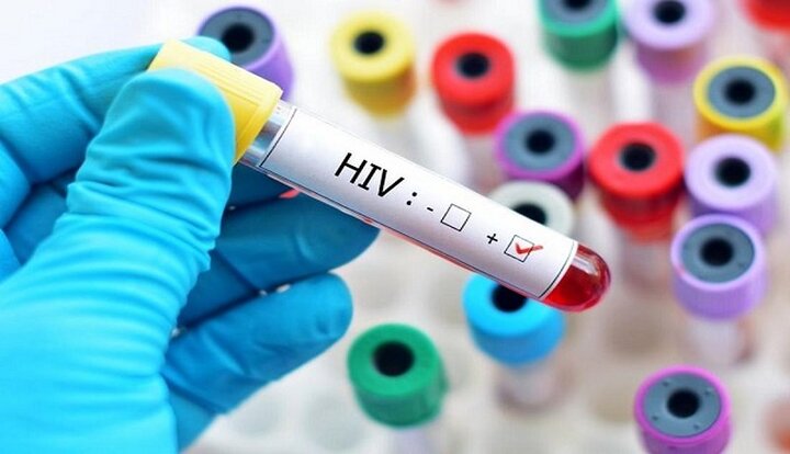 آمار رسمی ابتلا به ایدز در کشور اعلام شد / نیمی از مبتلایان در سال ۱۴۰۰ از راه جنسی مبتلا شدند