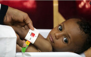 هشدار جدی درباره خطرات بیماری «وبا» برای کودکان