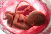 هشدار محققان درباره خطر سقط جنین در تابستان