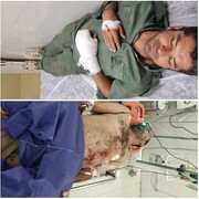 دو محیط‌بان بوشهری بر اثر تیراندازی شکارچیان آهو مجروح شدند