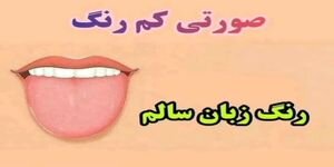 زبان شما چه رنگی است؟ / تشخیص بیماری از روی رنگ زبان +فیلم