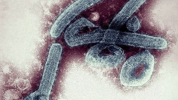 سر و کله ویروس جدید پیدا شد / ابتلا به ویروس مرگبار ماربورگ در جهان تایید شد! 