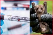 سازمان جهانی بهداشت شیوع «ویروس ماربورگ» را تایید کرد / علائم ابتلا به ماربورگ چیست؟